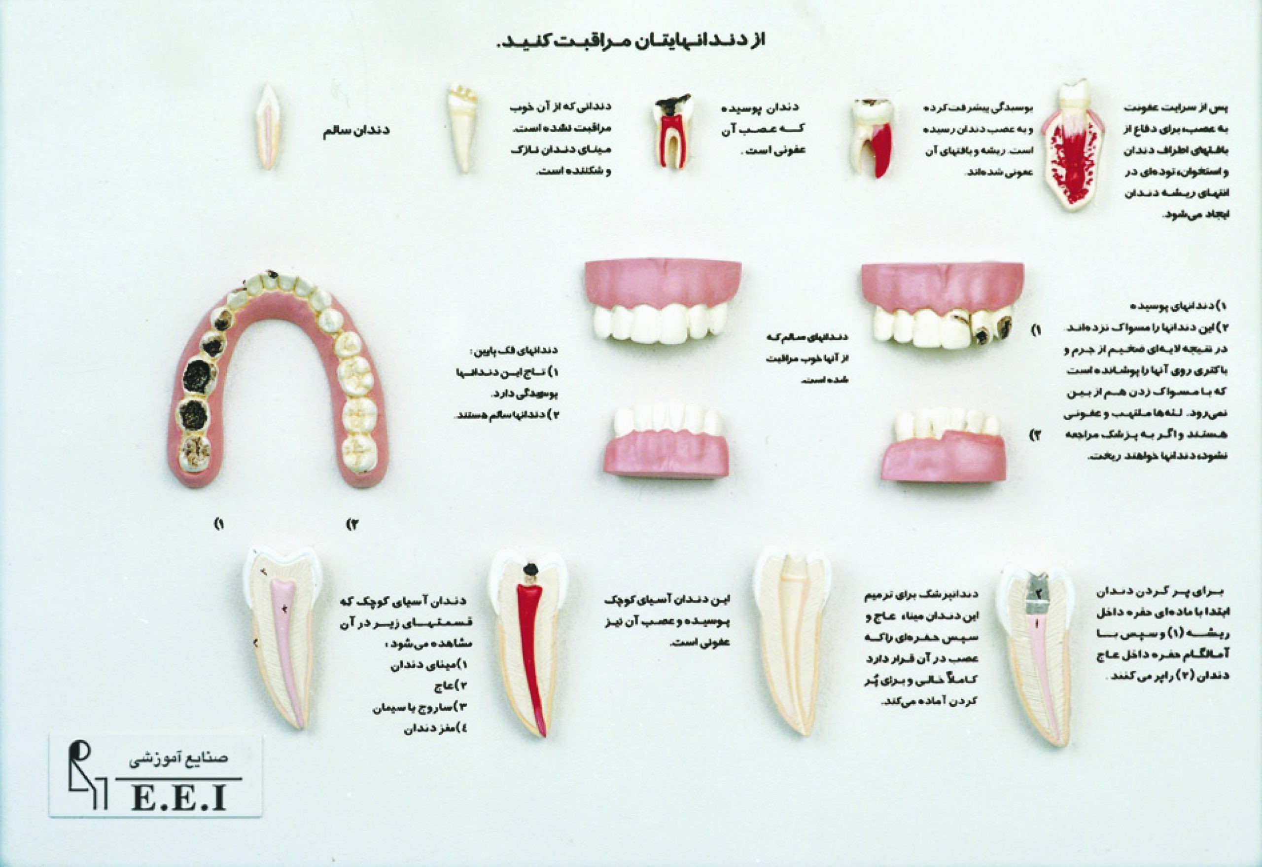 مولاژ مراقبت دندان