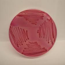 محیط کشت اندو آگار بیس (Endo agar base) کیولب